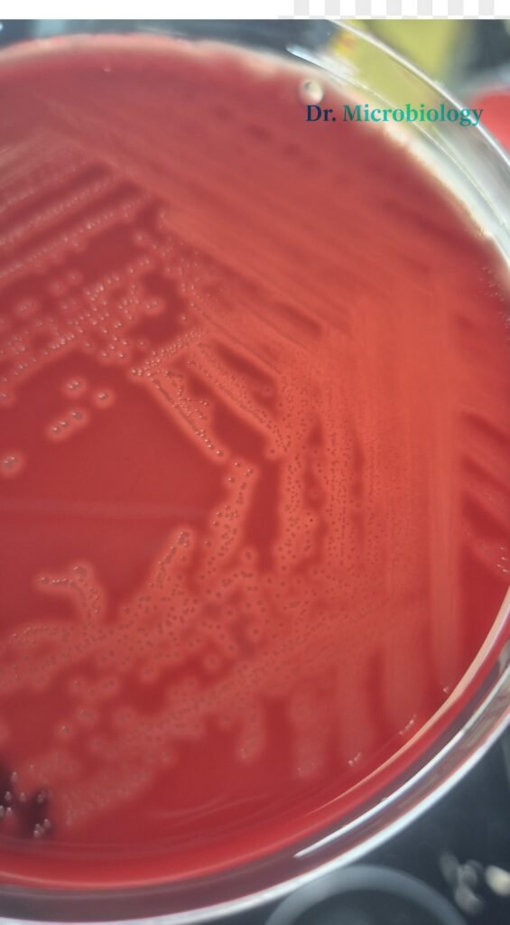 Streptococcus Pygones Blood Agar