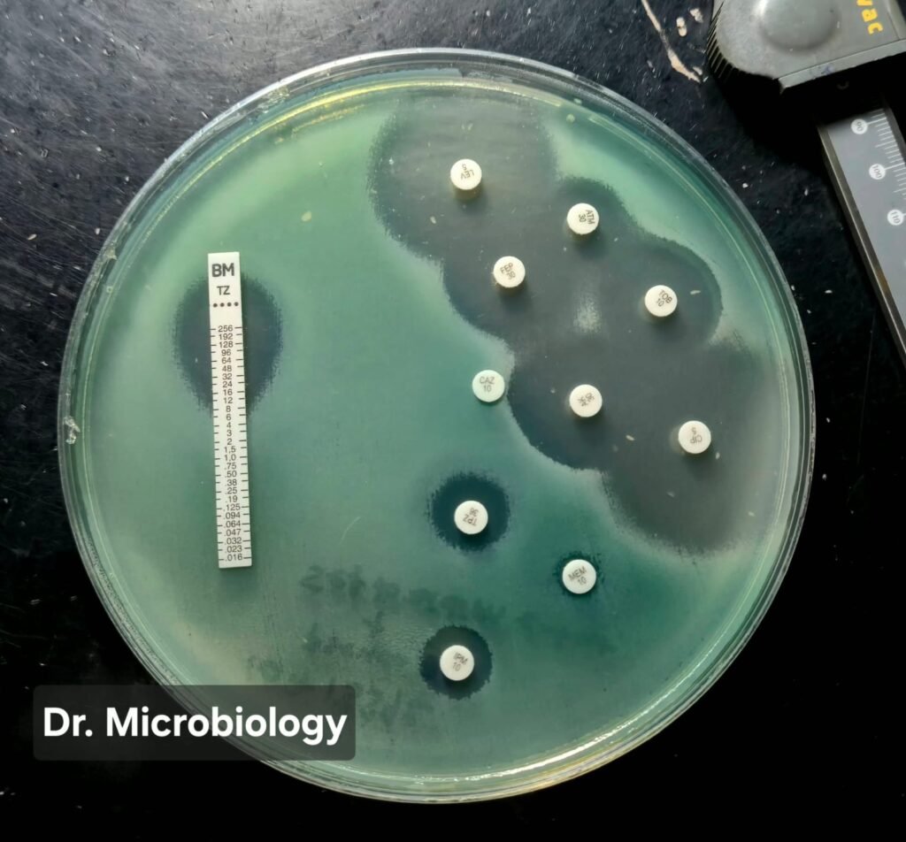 Pseudomonas aeruginosa antibiotic resistance disk diffusion test on Mueller-Hinton agar